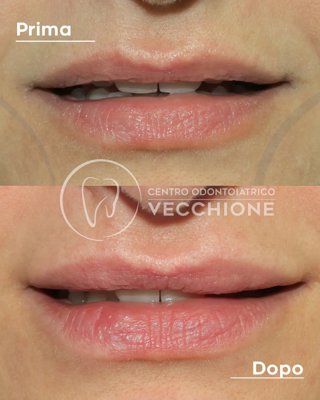 centro odontoiatrico dentista castellammare di stabia pietro vecchione