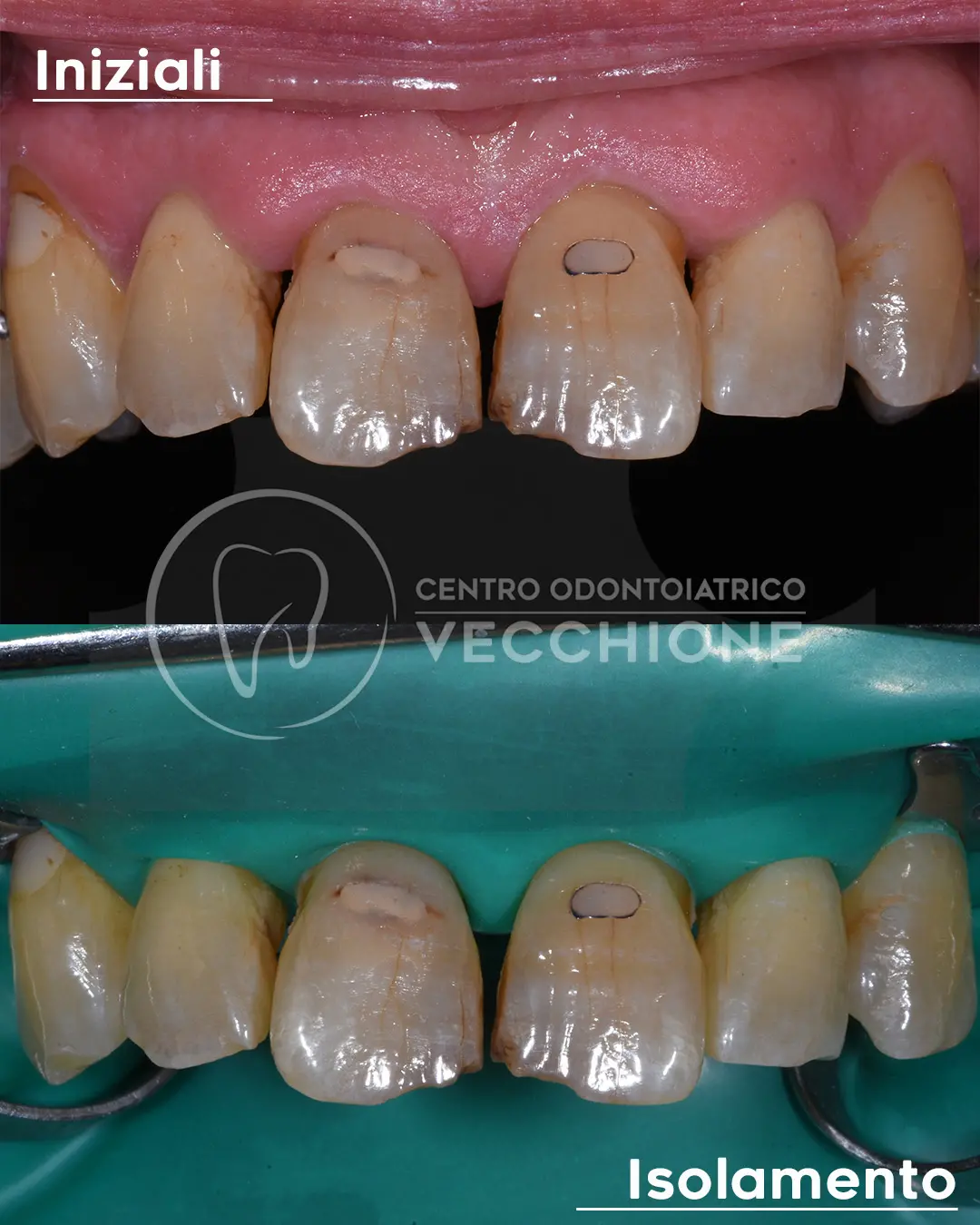 centro odontoiatrico dentista castellammare di stabia pietro vecchione