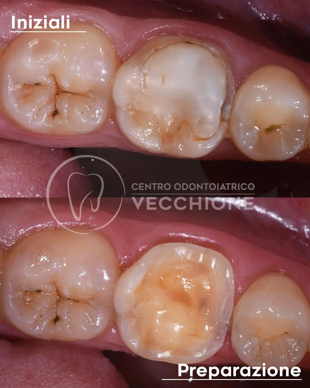 centro odontoiatrico dentista castellammare di stabia pietro vecchione