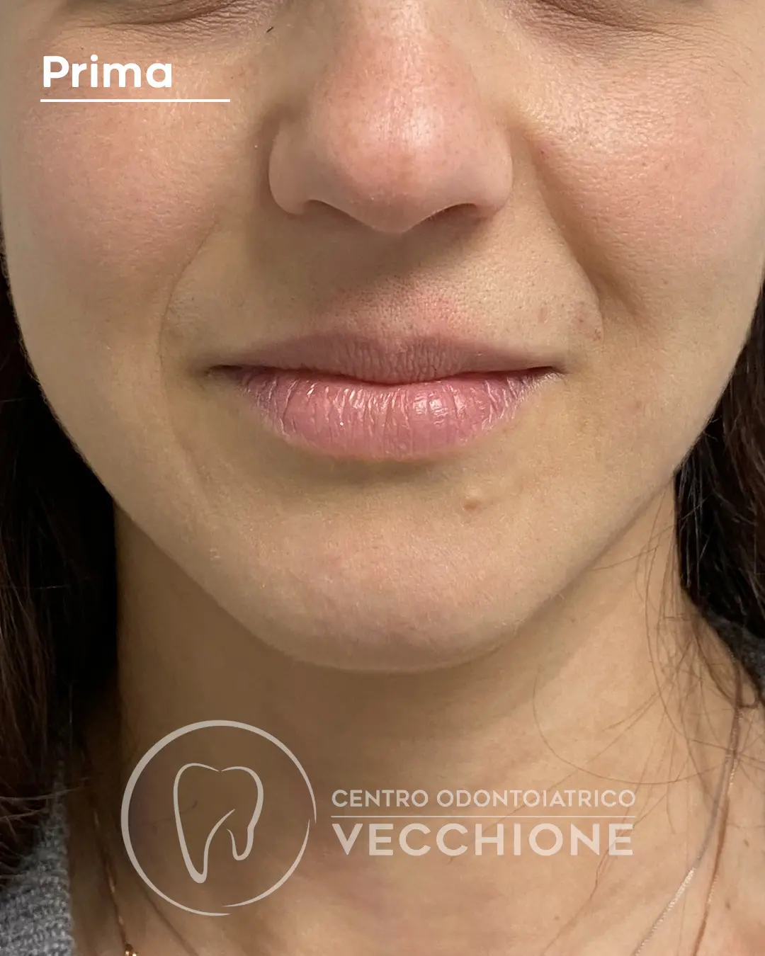 centro odontoiatrico dentista castellammare di stabia pietro vecchione