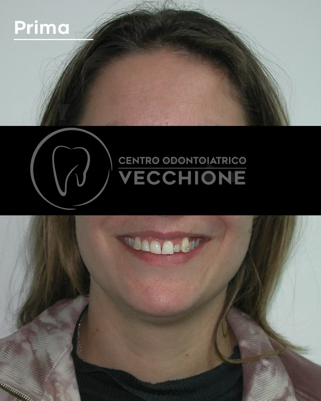 centro odontoiatrico dentista castellammare di stabia pietro vecchione