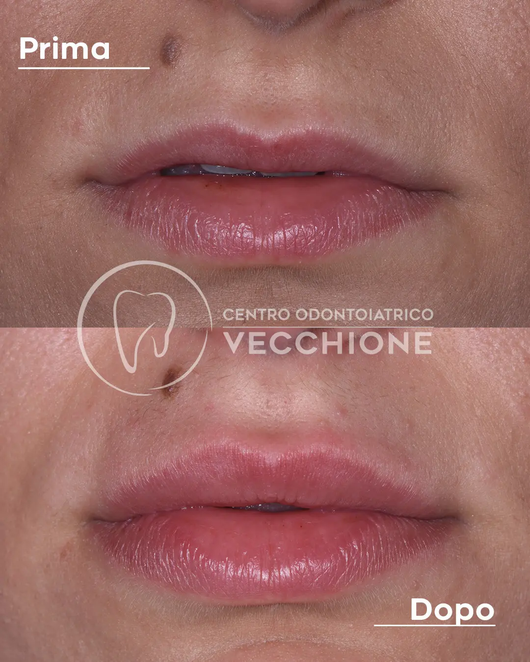 centro odontoiatrico dentista castellammare di stabia pietro vecchione