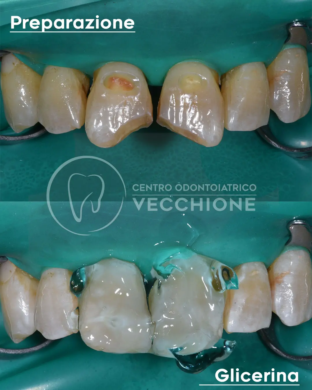 centro odontoiatrico dentista castellammare di stabia pietro vecchione