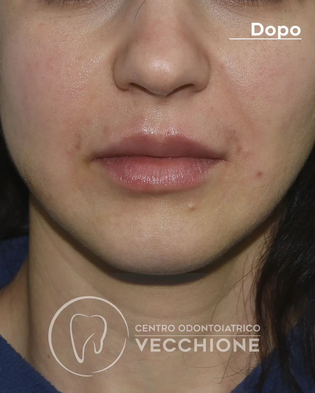 centro odontoiatrico dentista castellammare di stabia pietro vecchione