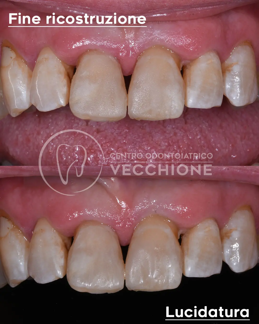 centro odontoiatrico dentista castellammare di stabia pietro vecchione