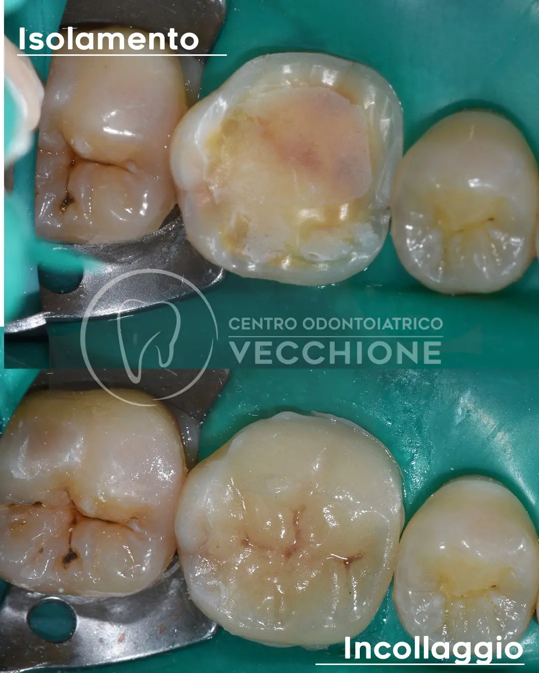 centro odontoiatrico dentista castellammare di stabia pietro vecchione