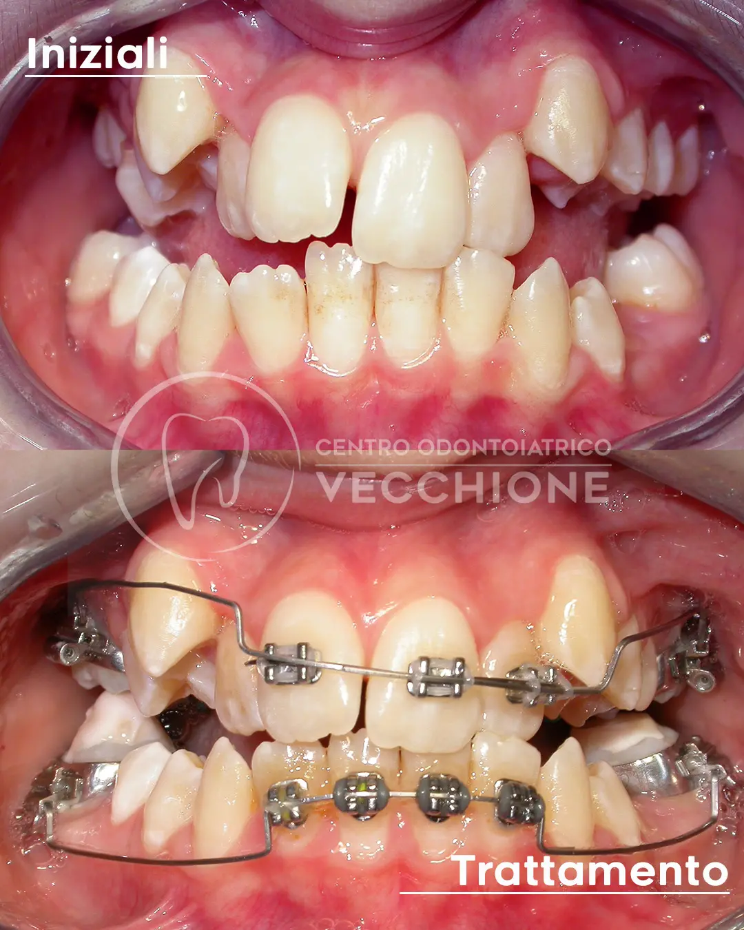 centro odontoiatrico dentista castellammare di stabia pietro vecchione