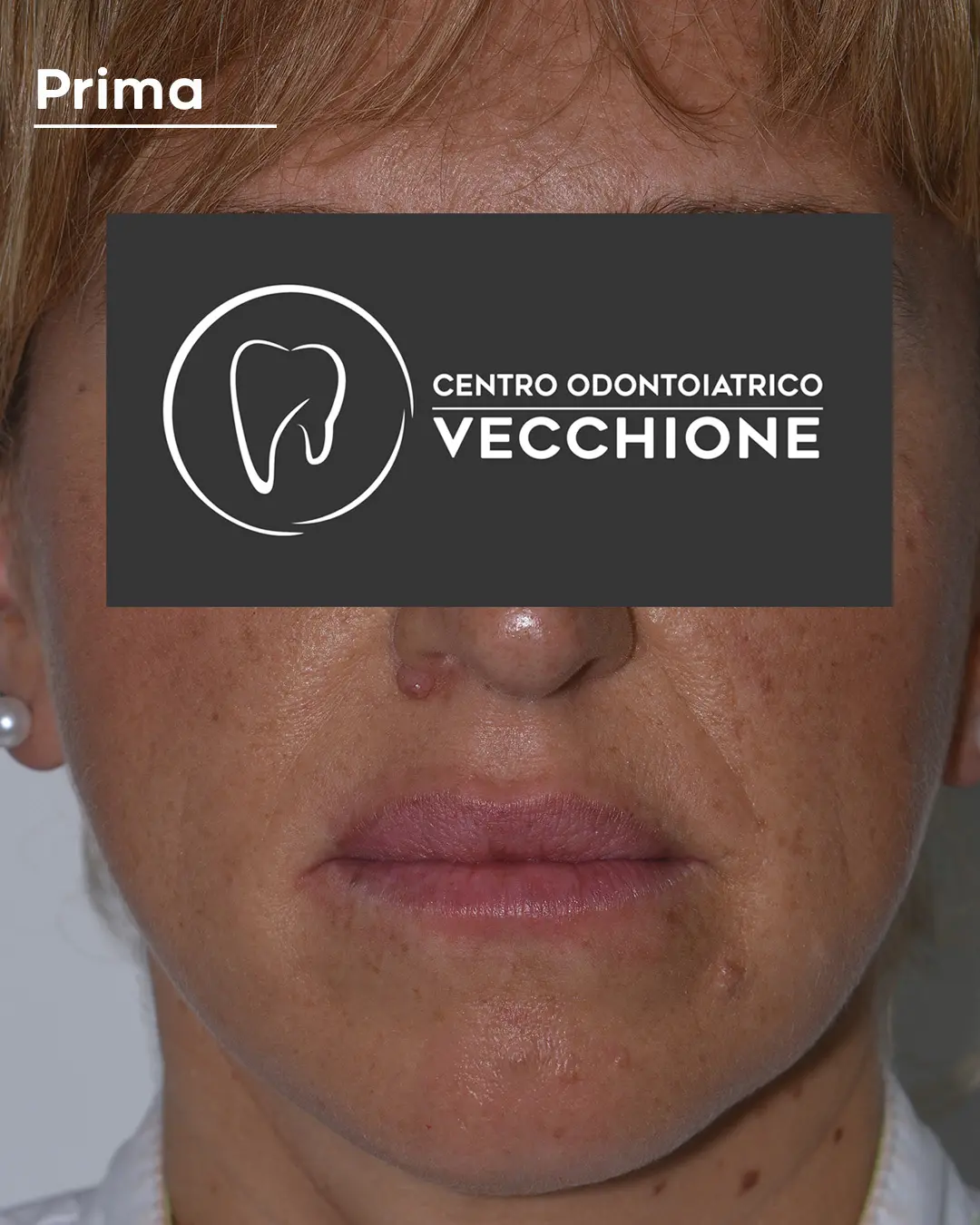 centro odontoiatrico dentista castellammare di stabia pietro vecchione