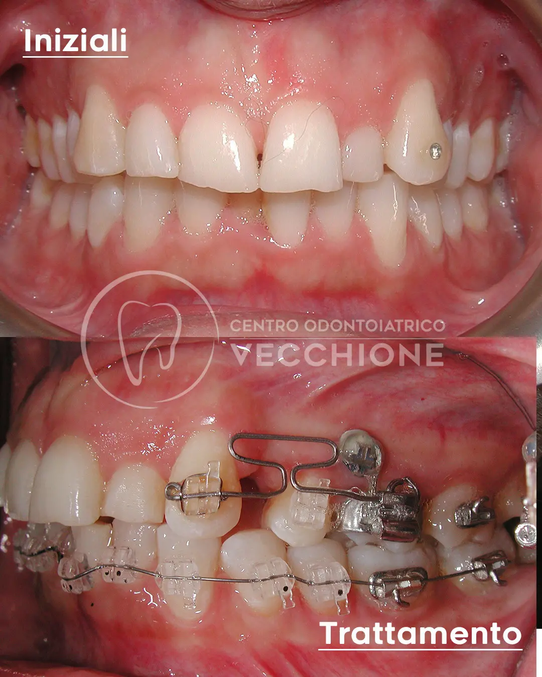 centro odontoiatrico dentista castellammare di stabia pietro vecchione