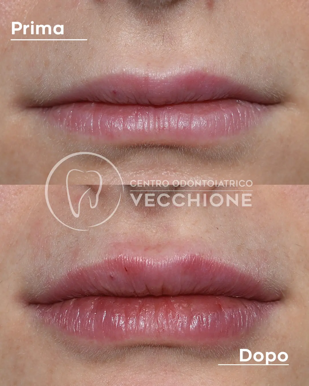 centro odontoiatrico dentista castellammare di stabia pietro vecchione