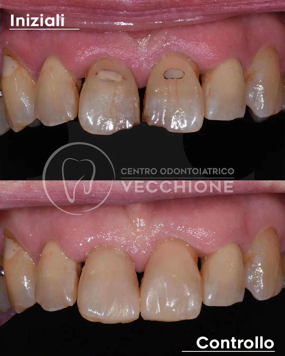 centro odontoiatrico dentista castellammare di stabia pietro vecchione