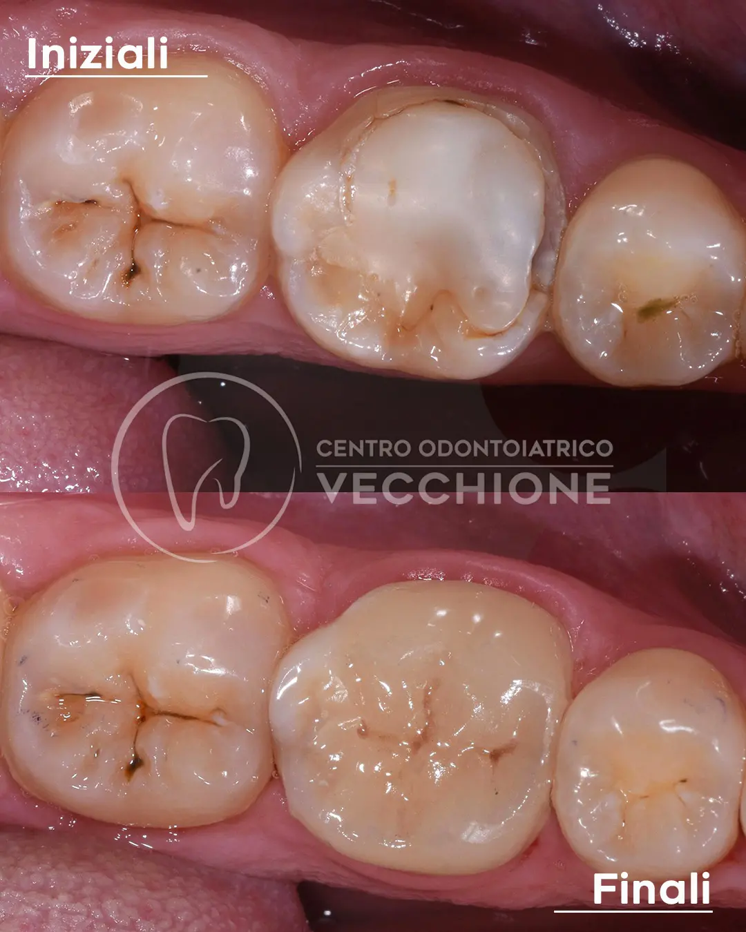 centro odontoiatrico dentista castellammare di stabia pietro vecchione