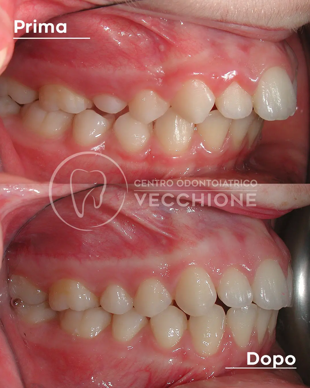centro odontoiatrico dentista castellammare di stabia pietro vecchione