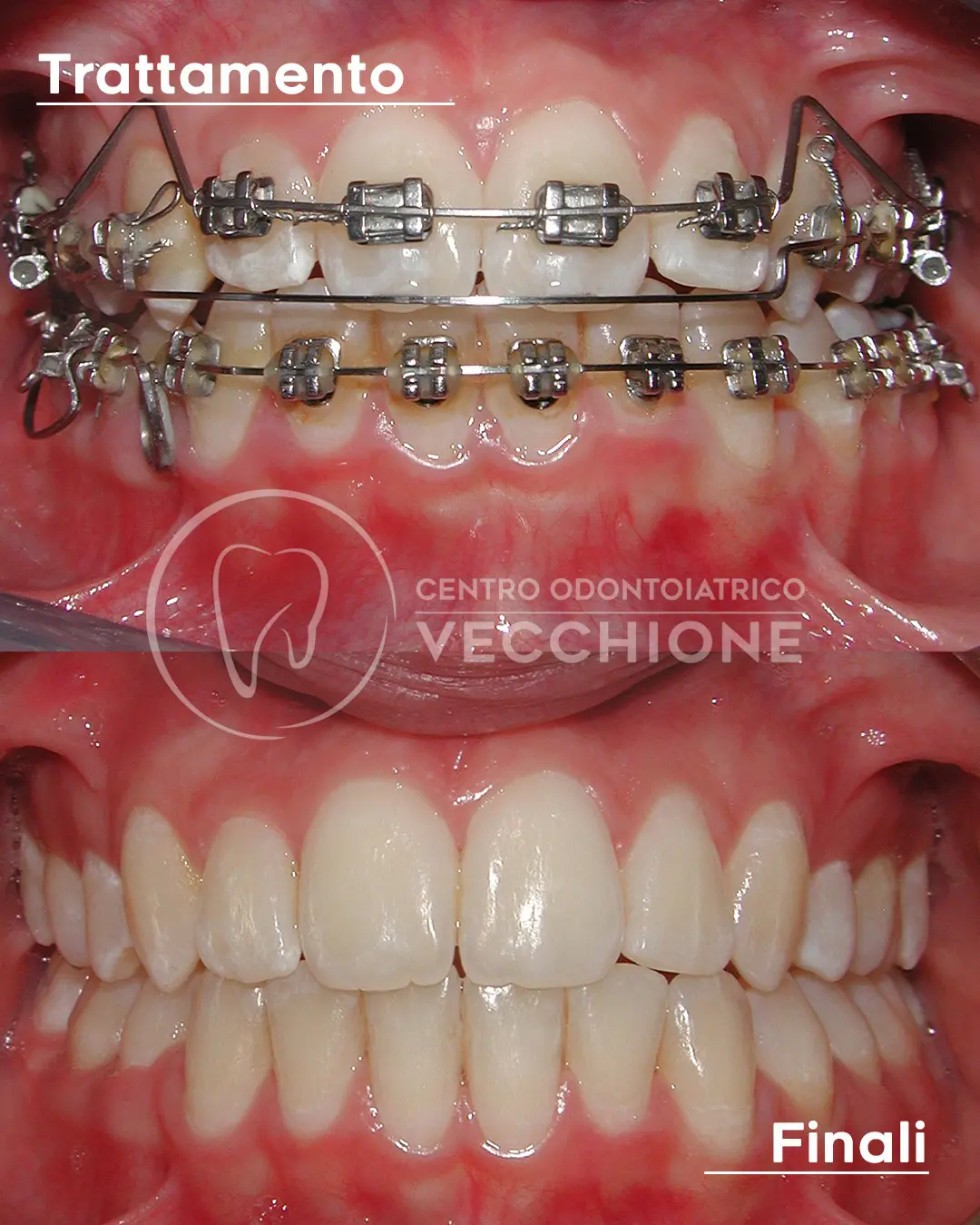 centro odontoiatrico dentista castellammare di stabia pietro vecchione