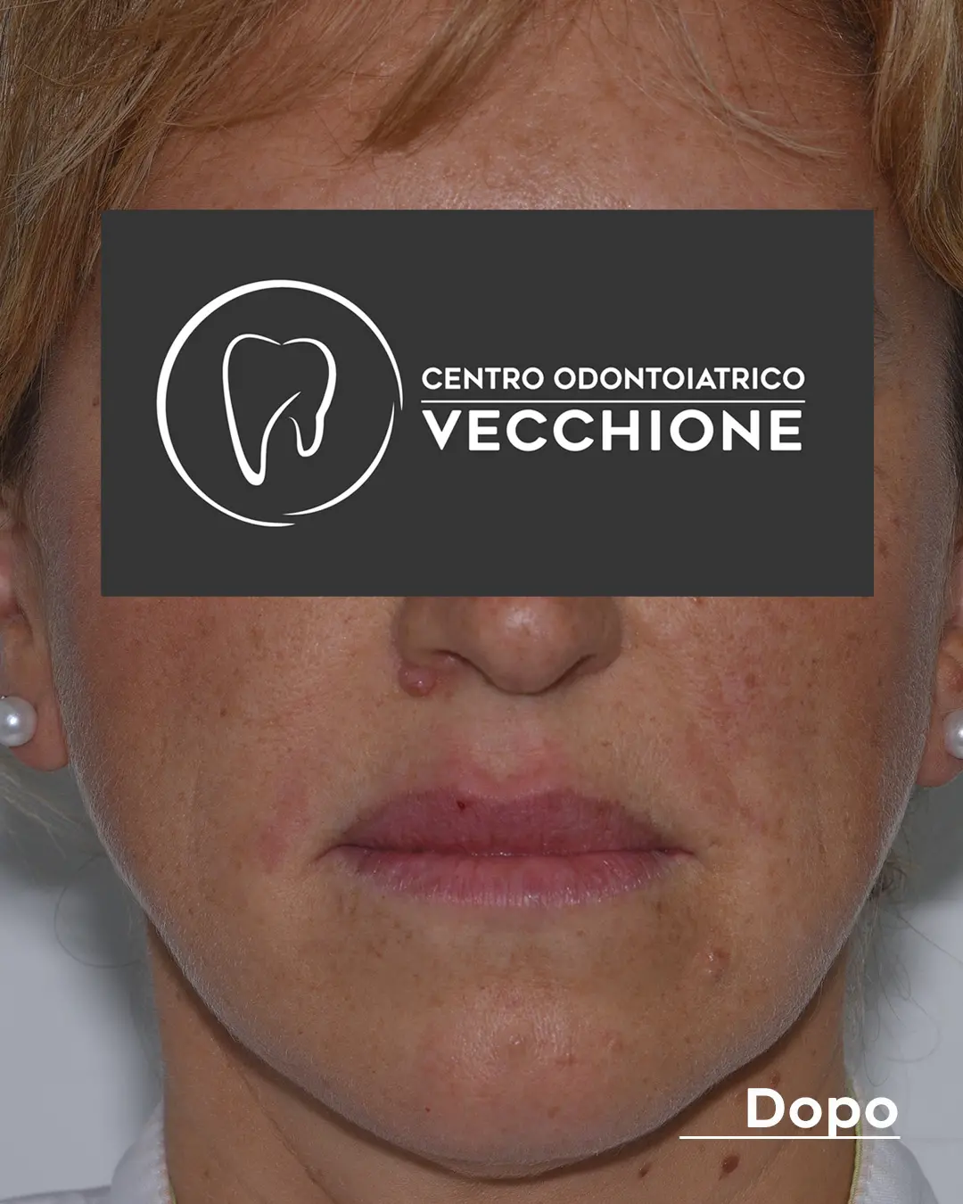 centro odontoiatrico dentista castellammare di stabia pietro vecchione