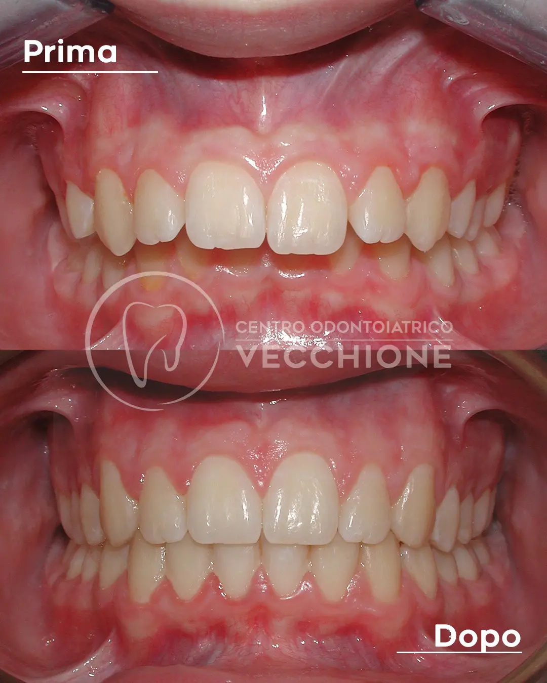 centro odontoiatrico dentista castellammare di stabia pietro vecchione