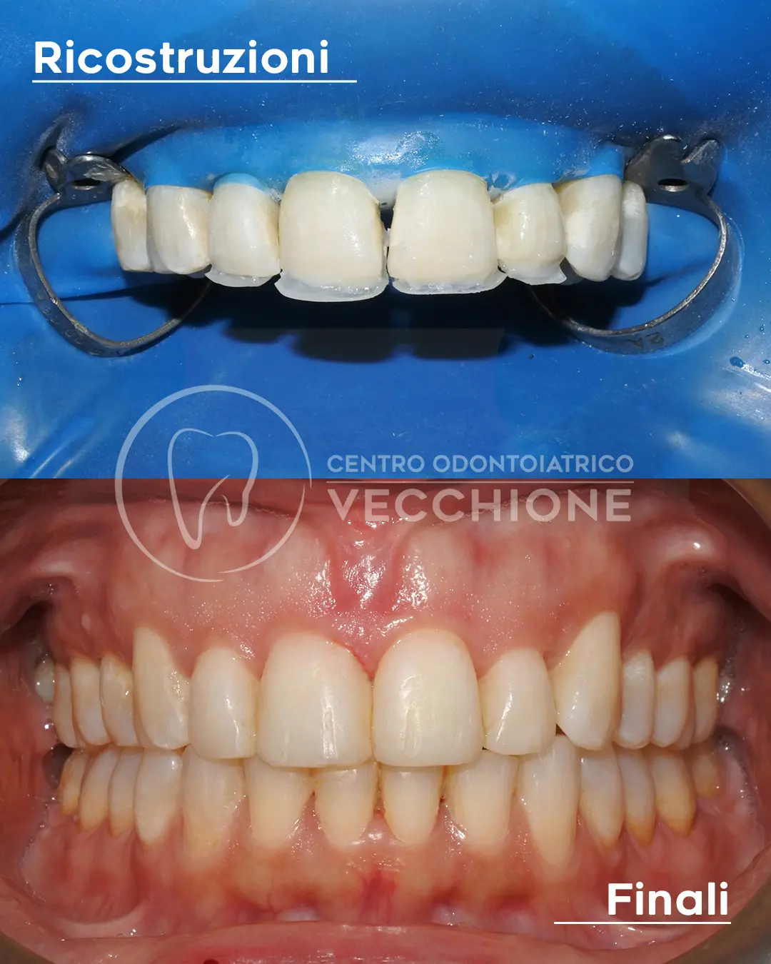 centro odontoiatrico dentista castellammare di stabia pietro vecchione