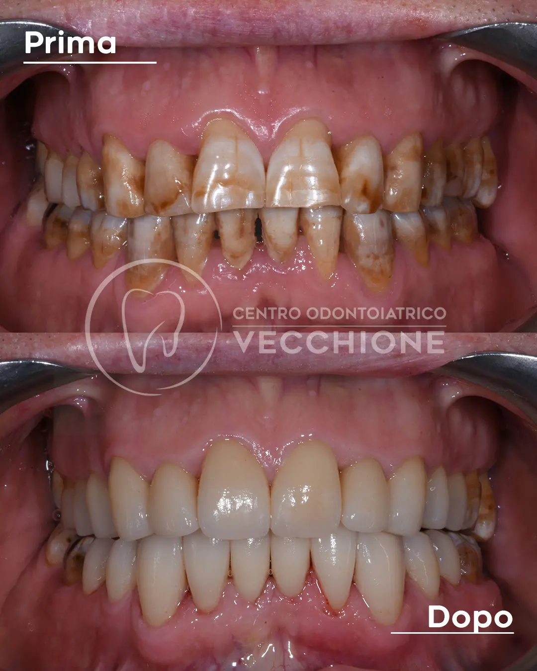 centro odontoiatrico dentista castellammare di stabia pietro vecchione