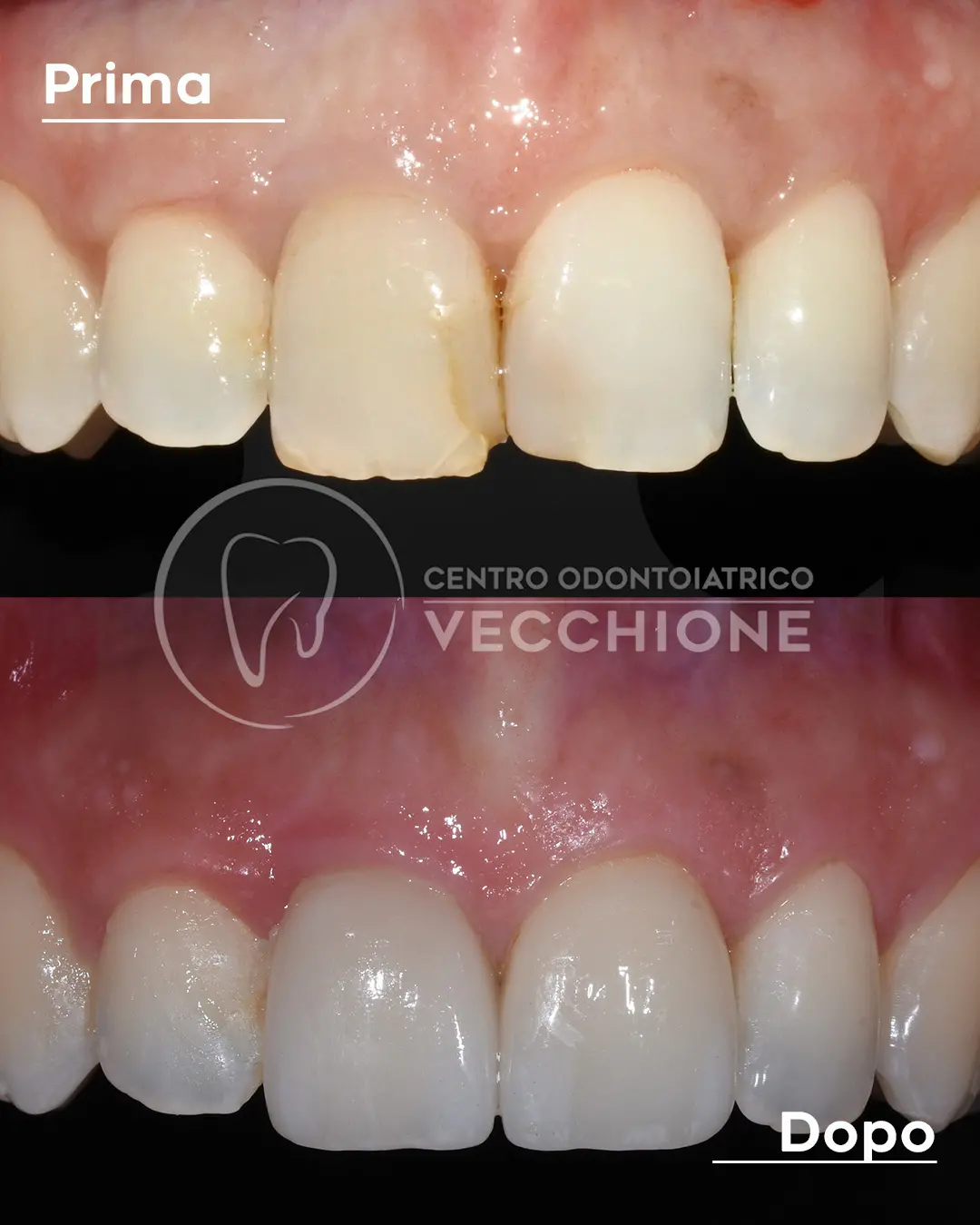 centro odontoiatrico dentista castellammare di stabia pietro vecchione