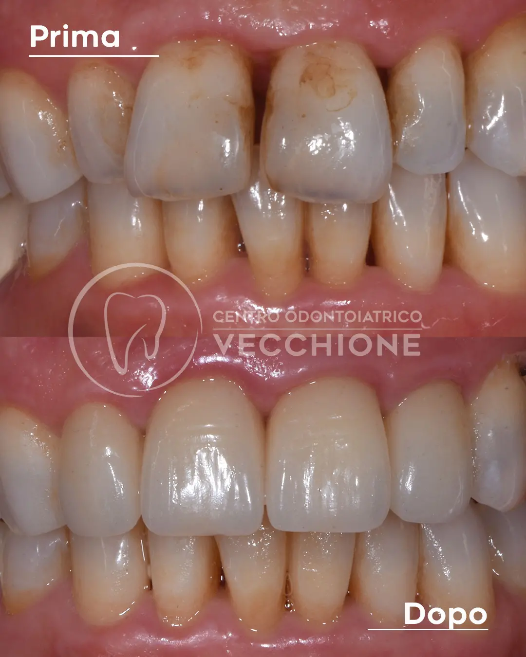 centro odontoiatrico dentista castellammare di stabia pietro vecchione