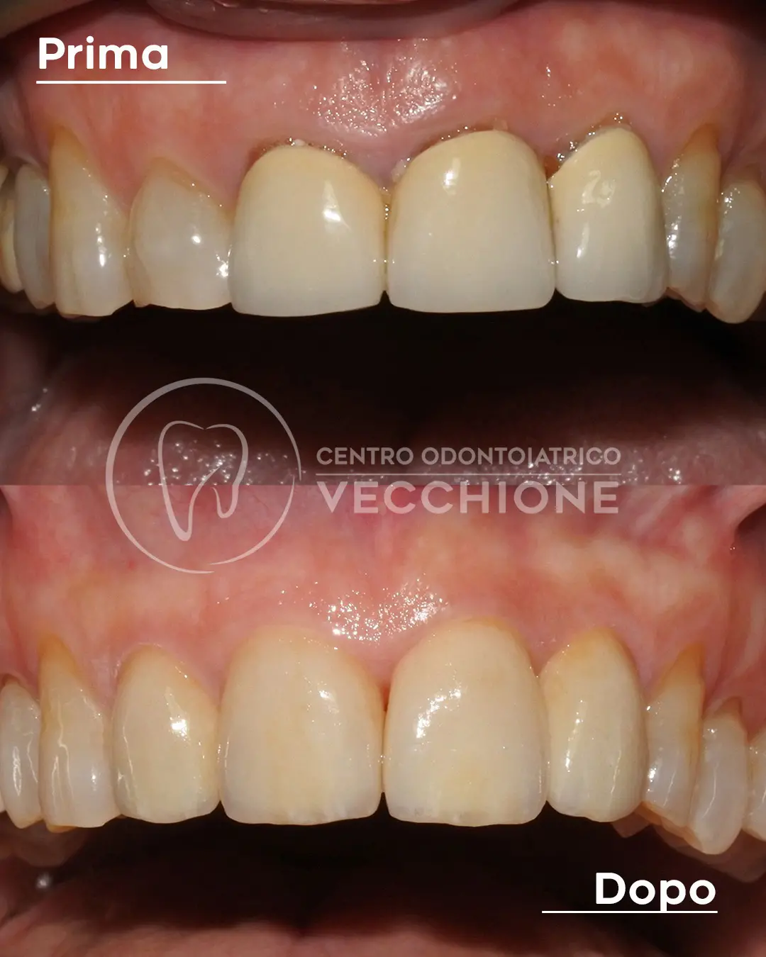 centro odontoiatrico dentista castellammare di stabia pietro vecchione