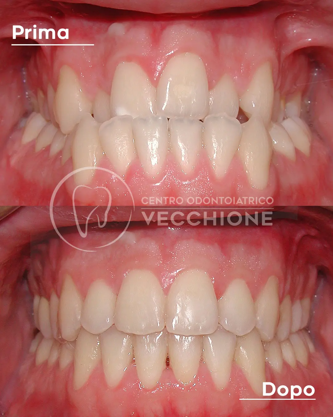 centro odontoiatrico dentista castellammare di stabia pietro vecchione