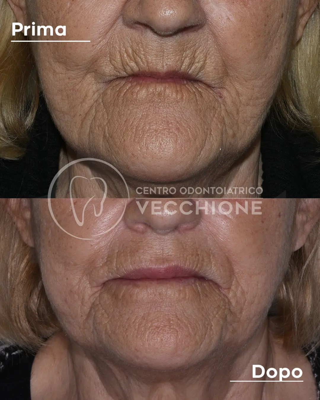 centro odontoiatrico dentista castellammare di stabia pietro vecchione