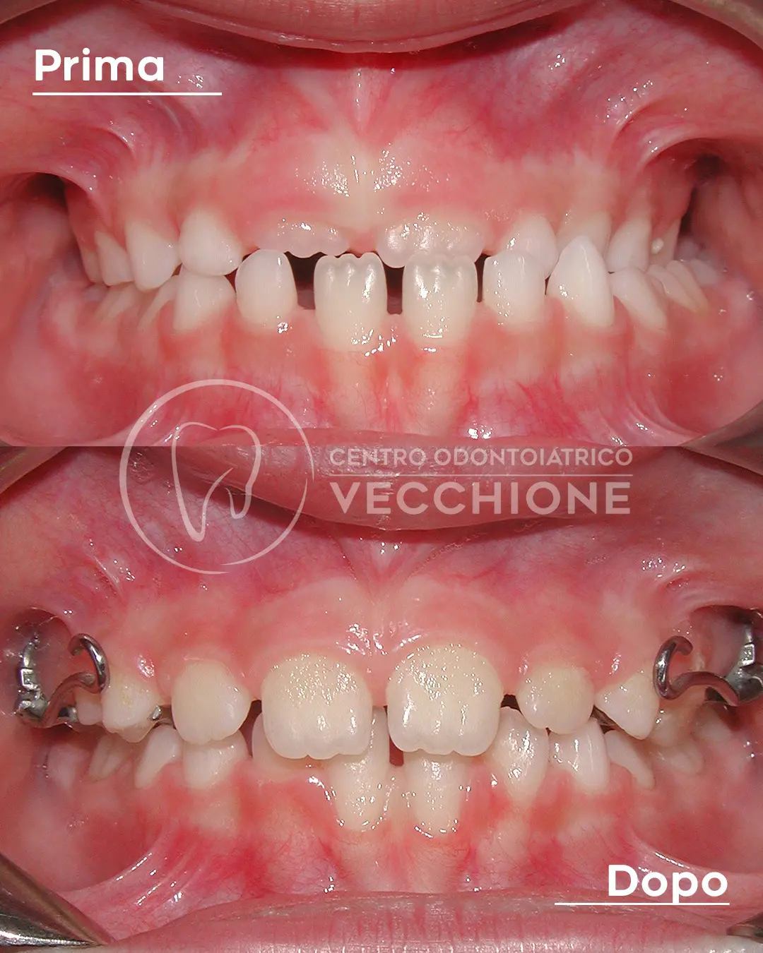 centro odontoiatrico dentista castellammare di stabia pietro vecchione