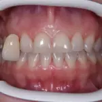 centro odontoiatrico dentista castellammare di stabia pietro vecchione