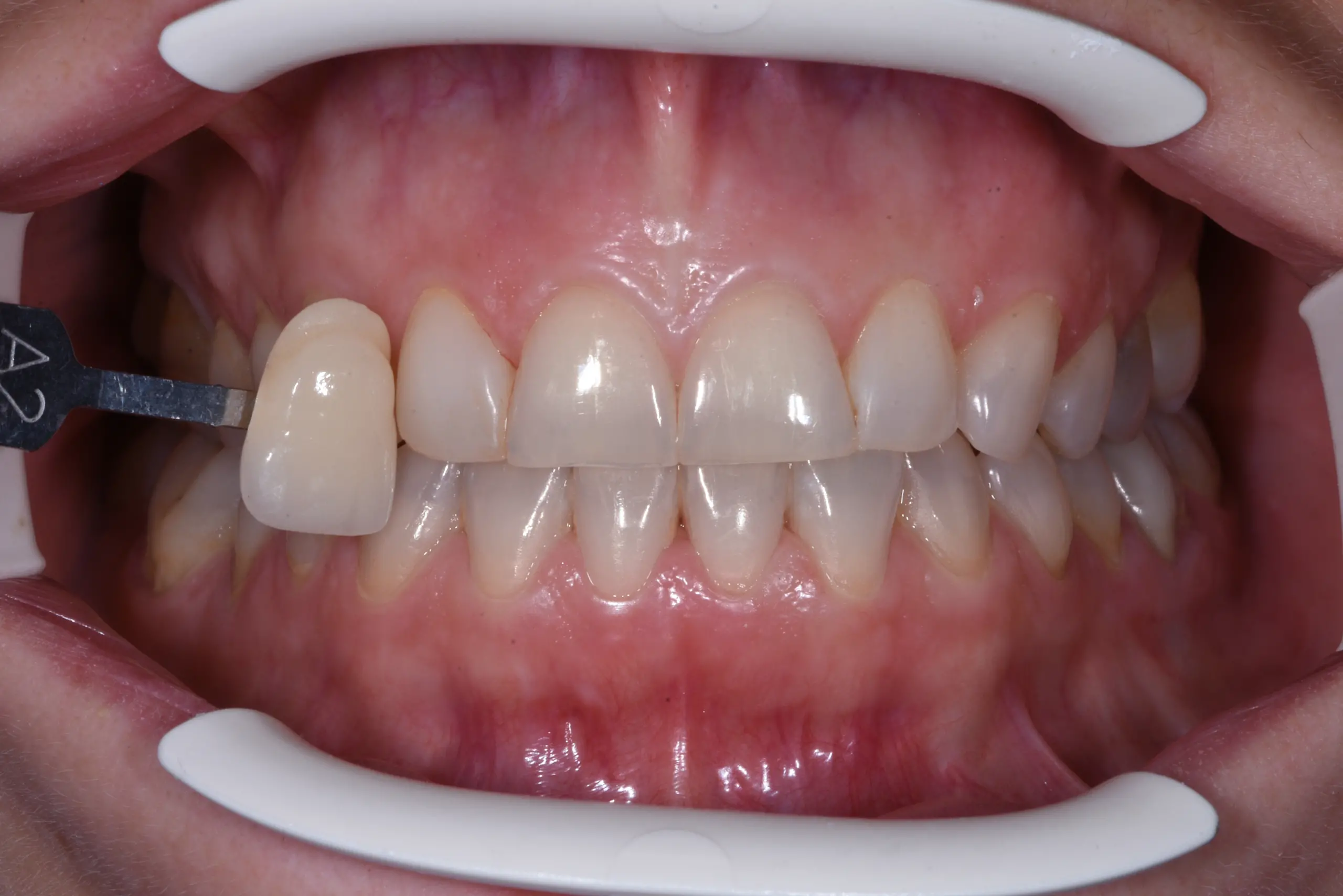 centro odontoiatrico dentista castellammare di stabia pietro vecchione